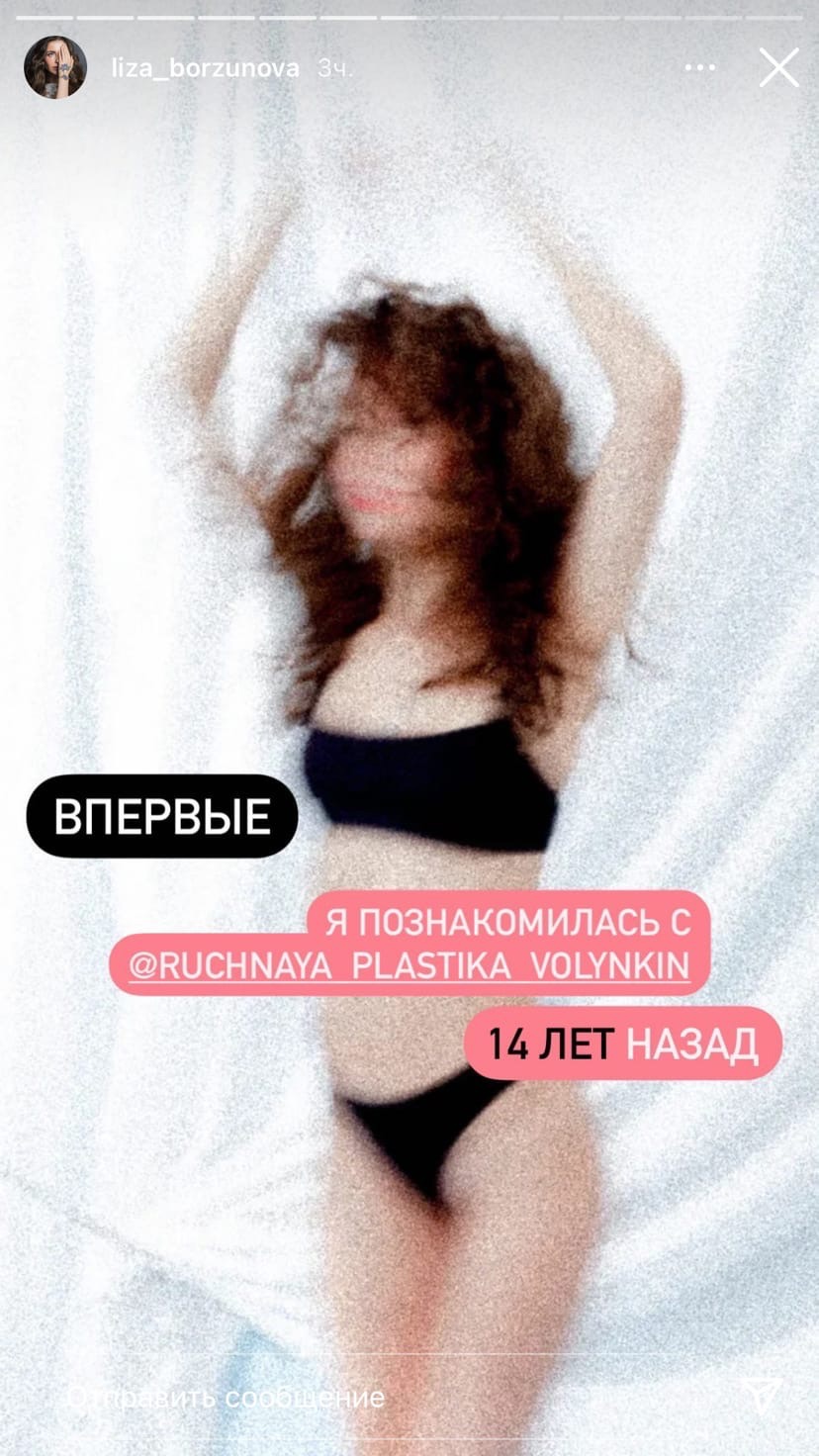 Liza Borazaya Елизавета Борзунова после Ручной Пластики Волынкина